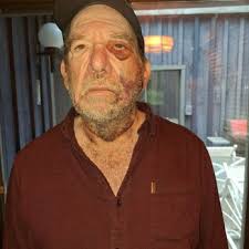 HEIGHTS DERMATOLOGY AND LASER