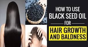 Baldness Black Growth Hair Kalonji Lore Oil Remedies Seed Black Seeds Of Nigella Sativa A Flower From Middle East Southwest Asia And Eastern Europe In 2020
