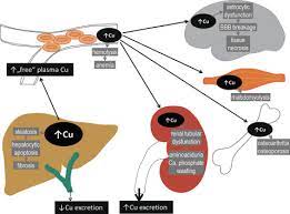 Copper Toxicity An Overview Sciencedirect Topics