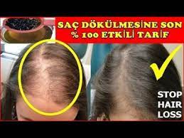5 Saccogaltan 100 Etkili 1 Haftada Sac Cikartiyor Sac Dokulmesine Son Ev Yapimi Dogal Tarif Dokulme Youtube 2020 Sac Sac Bakimi Sac Dokulmesi