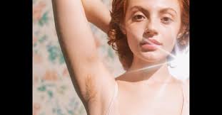 Telogen effluvium is a condition where the hair remains in the telogen (natural shedding) phase of the growth cycle. Excess Hair Acceptance And Pcos Mypcosteam