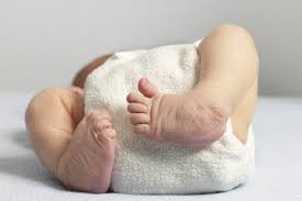 Clubfoot definition clubfoot is a condition in which one or both feet are twisted into an abnormal position at birth. Clubfoot Treatment Drhc Dubai Pediatric Orthopedic Clinic