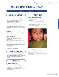 If you aren't sure which type of skin cancer. Xeroderma Pigmentosum Osmosis