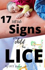 17 Lice Symptoms With Pictures Signs That You Have Head Lice In 2020 Head Louse Louse Lice Facts