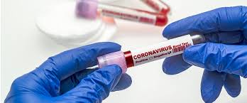Die bisher genutzten labortests zur igm negativ, igg negativ: How To Interpret Coronavirus News In Light Of False Negatives Analytics Magazine