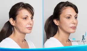 Clínica de Medicina Estética Dr. Rafael Bustos