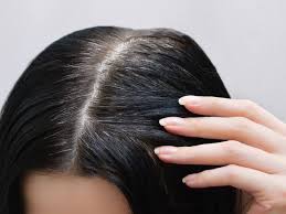 Dan yang paling sedih sekali is age limit semakin menurun dari sehari ke sehari. Tumbuh Uban Di Usia Muda Ini 8 Penyebabnya