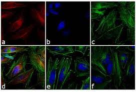 Alexa fluor dyes are frequently used as cell and tissue labels in fluorescence microscopy and cell biology. Donkey Anti Mouse Igg H L Highly Cross Adsorbed Alexa Fluor 546 A10036