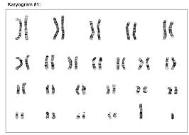 Karyograms Bioninja