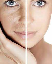 Cách nhận biết da khô và da mất nước - Mỹ phẩm cao cấp Dr Belter chuyên  dùng cho spa