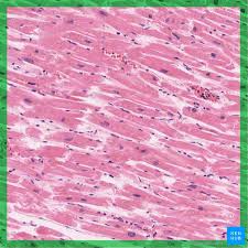 From wikimedia commons, the free media repository. Cardiac Muscle Tissue Histology Kenhub