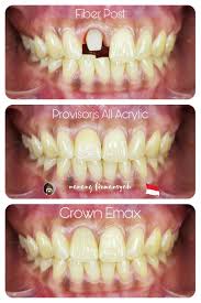 The company which offer you the best solutions for your needs. Emax Crown