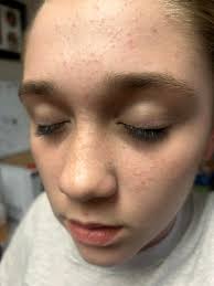 What could be causing itchy bumps