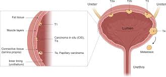 Frontiers Treating Bladder Cancer Engineering Of Current And Next Generation Antibody Fusion Protein Mrna Cell And Viral Based Therapeutics Oncology