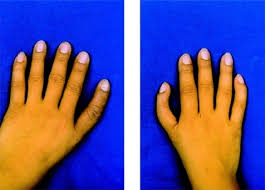 Image result for Hand Exam