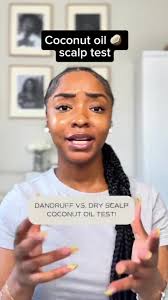 Dandruff and dry scalp are NOT the same. And they require different  solutions! Here’s a quick test to see which you might have: Before you go  to bed, apply coconut oil to an area where you’ve noticed ...