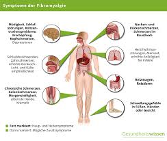 Fibromyalgie Ursachen Symptome Diagnose Behandlung