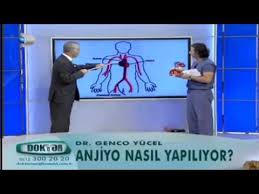 Anjiyo Nasil Yapiliyor Youtube