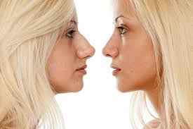 Die nasenkorrektur, medizinisch als rhinoplastik bezeichnet, gehört seit jahren zu den beliebtesten schönheitsoperationen, und das mit steigendem trend: Rhinoplastik Acibadem Beauty Center