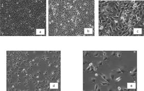 Image result for Hymenodictyon parvifolium