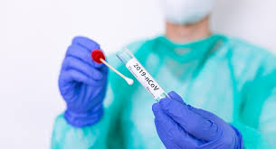 Posted 11m ago11 minutes ago. Here S How To Get A Coronavirus Test In Ottawa And Eastern Ontario Ctv News