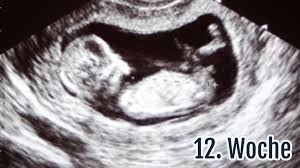 Bei diesem screening achtet der arzt darauf, ob es sich um einen fötus oder eine mehrlingsschwangerschaft handelt. 12 Ssw Die 12 Schwangerschaftswoche Fehlgeburtsrisiko Tipps Netmoms De