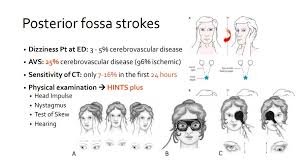 Image result for HiNTs Exam