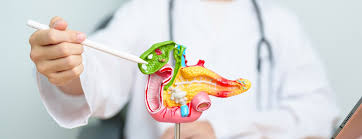 Image result for Gallstone