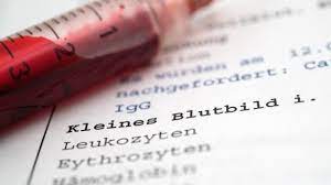 Hct Rbc Und Got Was Abkurzungen Beim Blutbild Bedeuten