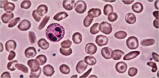 Image result for Anemia angolensis