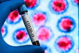 Ianuarie · februarie · martie · aprilie · mai · iunie · iulie · august · septembrie · octombrie · noiembrie · decembrie. Coronavirus In Romania Live Update 2 Iunie 164 Cazuri Noi Si 62 De Decese In Ultimele