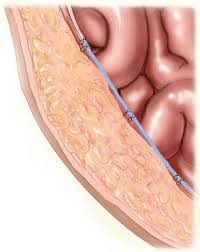 Pin On Health