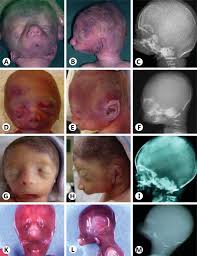 Image result for Dignathia