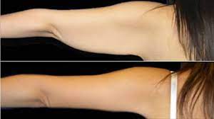 Maybe you would like to learn more about one of these? Elimina Los Gorditos De Los Brazos En 20 Dias Elimina Los Gorditos Youtube