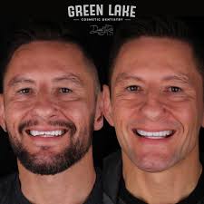 Green Lake Cosmetic Dentistry