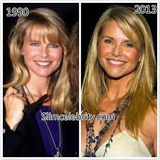 Gone are the days when you could spot somebody who had plastic surgery procedures with ease. Christie Brinkley Plastic Surgery Before And After Photos Face Lift Eyelid Surgery And Fillers Operasi Plastik Christie Brinkley