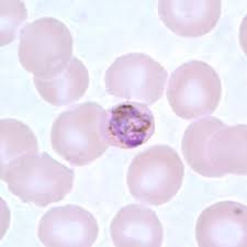 Plasmodium malariae is a parasitic protozoa that causes malaria in humans. Malaria Plasmodium Malariae Gametocytes