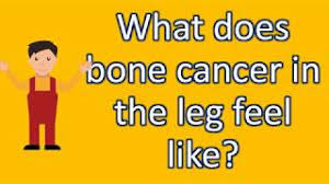 Bone pain can cause a dull or deep ache in a bone or bone region (e.g., back, pelvis, legs, ribs, arms). What Does Bone Cancer In The Leg Feel Like Faqs On Health Youtube