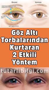 Goz Alti Torbalarindan Ve Kirisikliktan Kurtaracak 2 Yontem Saglikli Cilt Bakimi Dogal Guzellik Ipuclari Dogal Cilt Bakimi