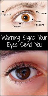 Warning Signs Your Eyes Send You Health Signs Eye Health Warning Signs