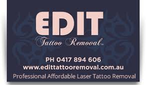 Tattoo Removal Cost