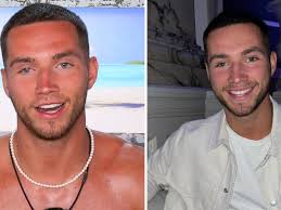 What happened to Ron Hall's eye? Love Island star's injury and blindness  explained