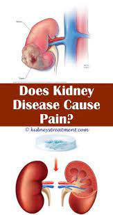 Kidney Health Stones Treatment For Kidney Disease Kidney Disease Kidney Disease Symptoms