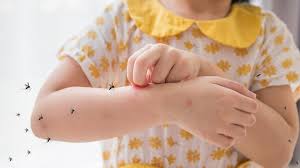 तेलंगाना में बच्चों में चिकनगुनिया के मामलों में वृद्धि, विशेषज्ञ ने मानसून  के दौरान अपने बच्चों को सुरक्षित रखने के लिए सुझाव दिए | OnlyMyHealth