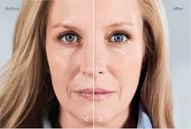 From Louisiana to San Francisco: Brittany's Journey in Medical Aesthetics