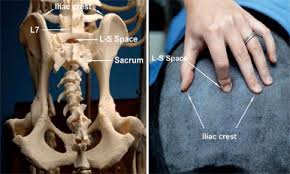 Image result for Intrapleural Anesthesia