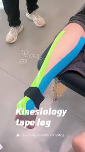 Image result for Taping for Soleus and Achilles