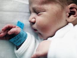 Image result for Neonatal Circumcision