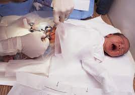 bezli bebeklerde sunnet sonrasi bakim nasil olmalidir yenidogan bebeklerde sunnet