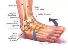The tear is repaired with suture above. How Is An Inferior Extensor Retinaculum Injury Formed How Should You Treat It Quora